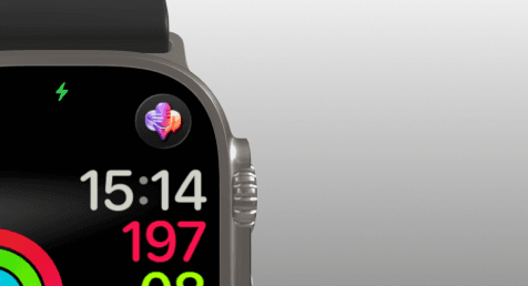 Apple Watch face with VivaDicta complication
